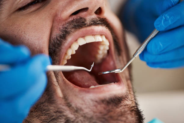 Best Cosmetic Dentistry  in Odessa, MO